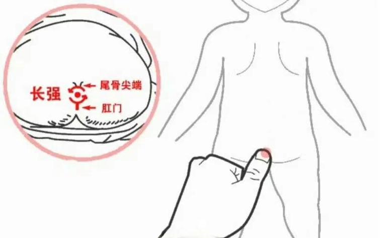 长强穴位坐着有点涨