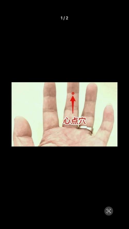 治疗心脏早搏的穴位