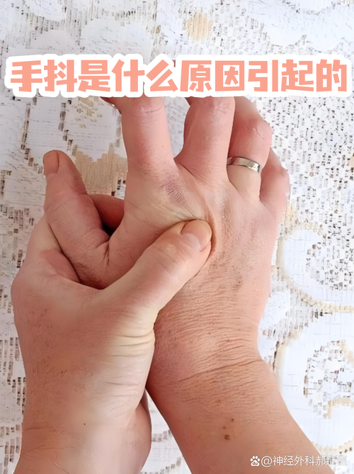 甩手功能治疗类风湿吗