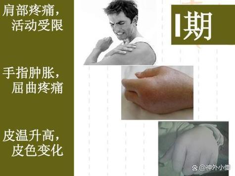 脑梗肩膀疼是什么原因