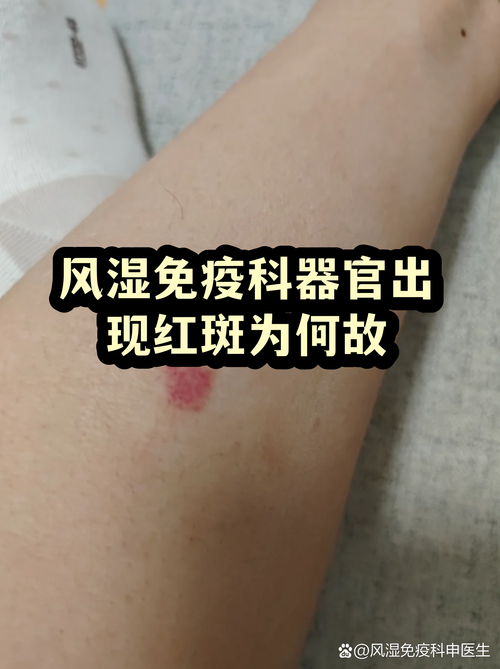 大理有风湿免疫内科吗