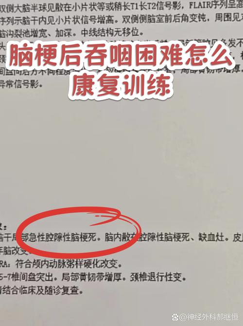 脑梗吞咽困难能活多久