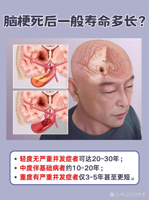脑梗吞咽困难能活多久