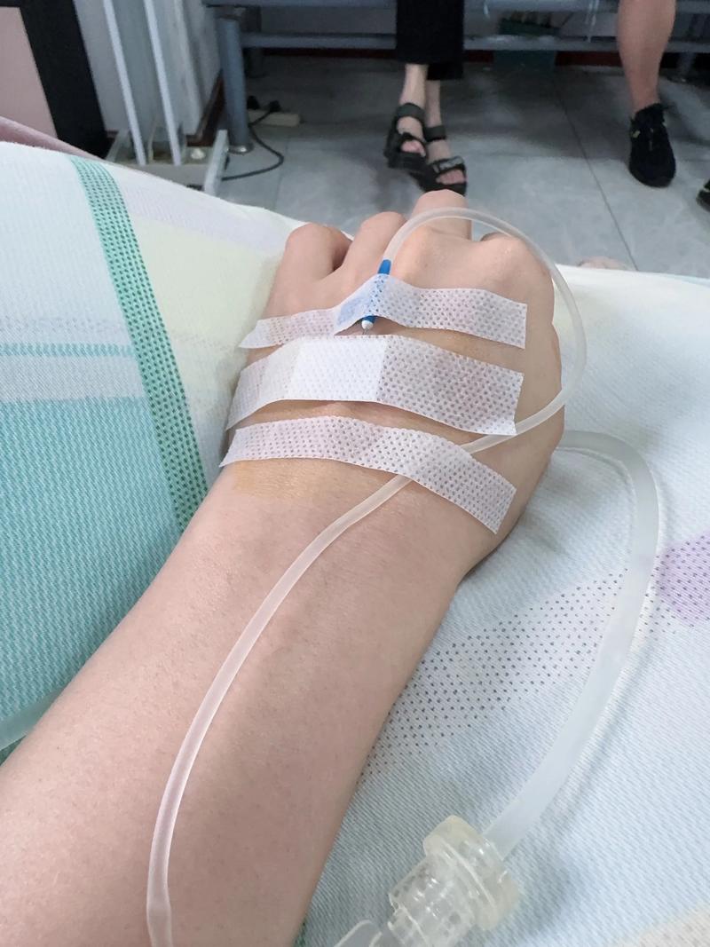 类风湿输液的效果好吗