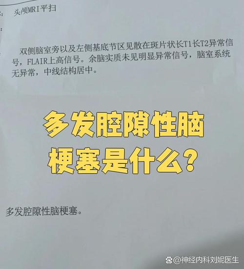 多发性脑梗是什么意思