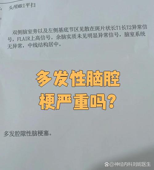 多发性脑梗是什么意思