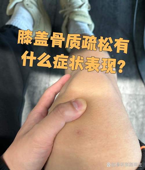 骨质疏松和风湿的症状