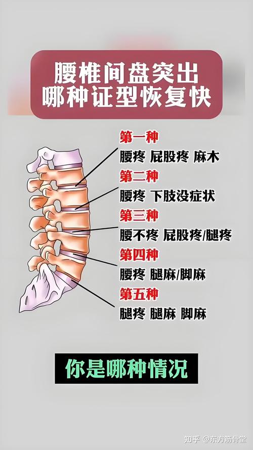 腰椎类风湿要注意什么