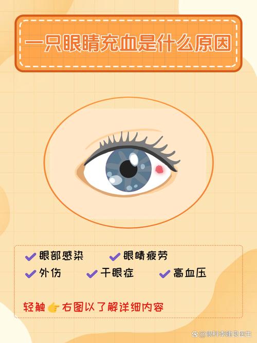 脑梗眼睛充血怎么回事