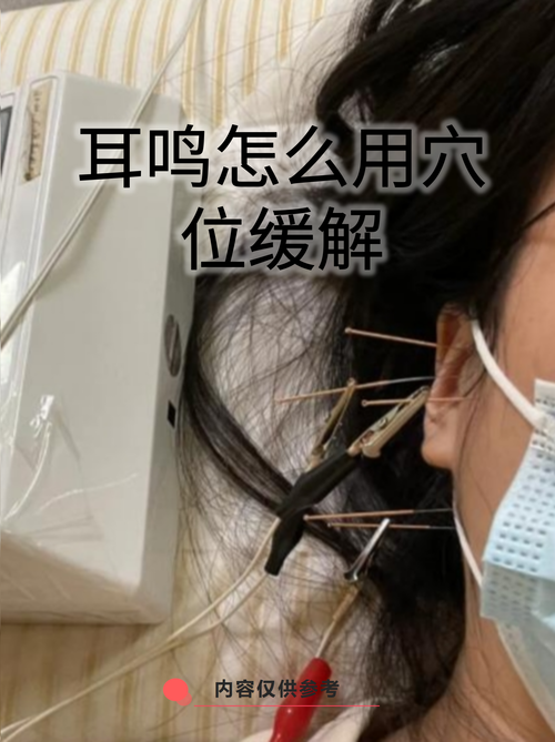 耳鸣按哪个穴位视频