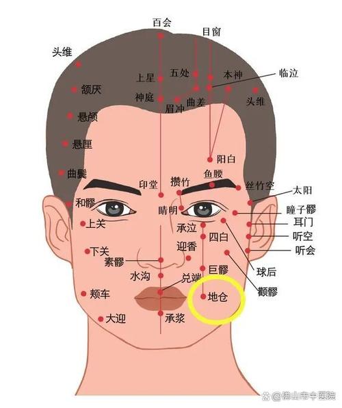 面瘫治疗针灸穴位图