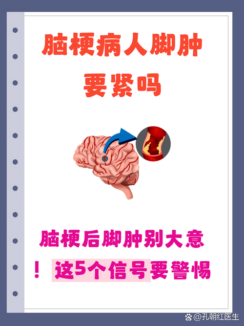 脑梗病人脚肿怎么回事