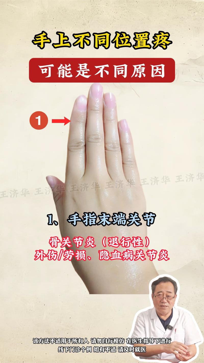 手背风湿肿痛怎么缓解