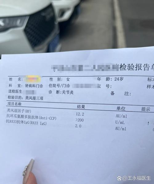 类风湿因子多少为正常