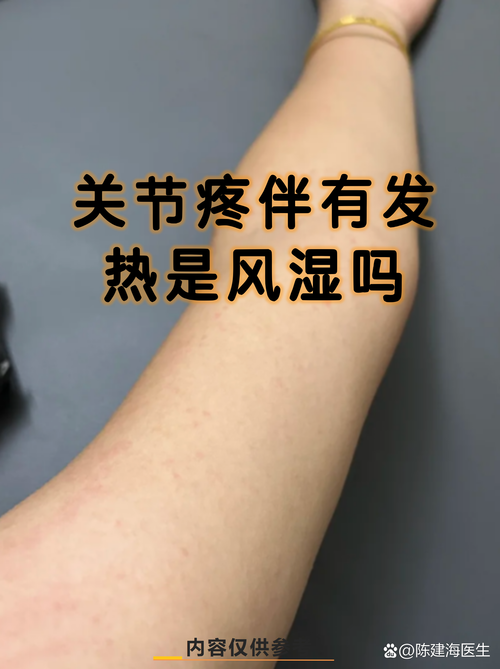 风湿会引起全身酸痛吗