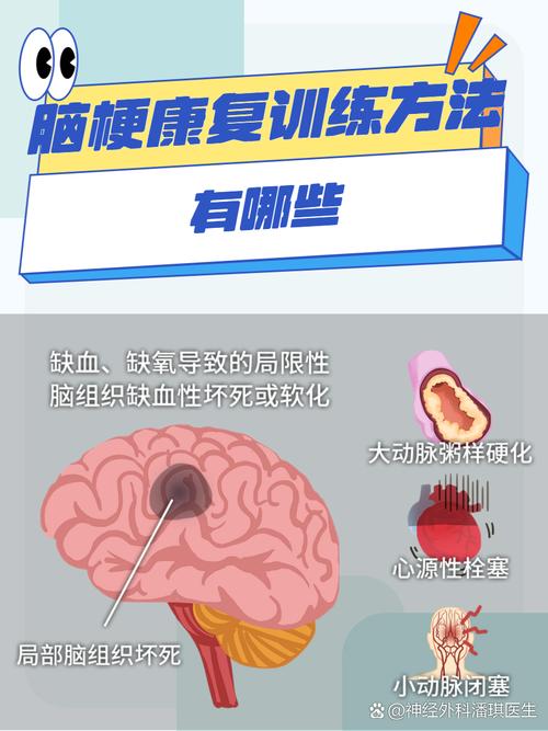 脑梗早期怎么治疗最好