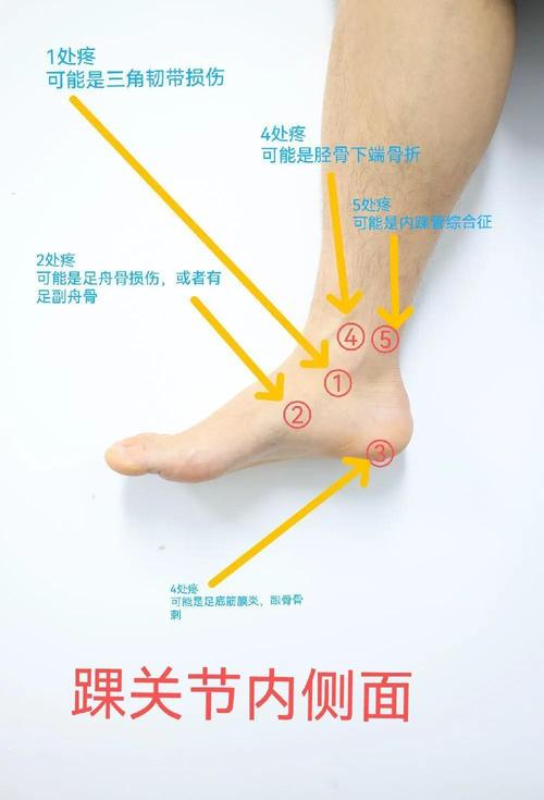 脚踝以下有几个穴位