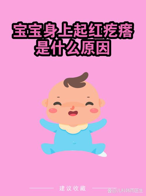 婴儿干燥型湿疹穴位