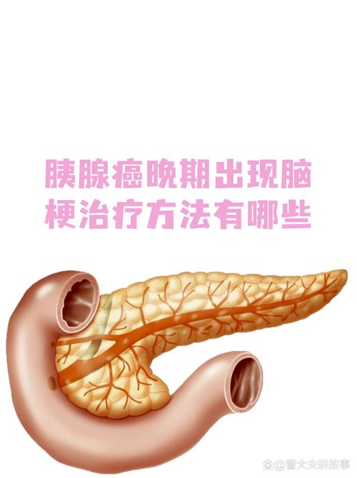 脑梗口齿不清能恢复吗