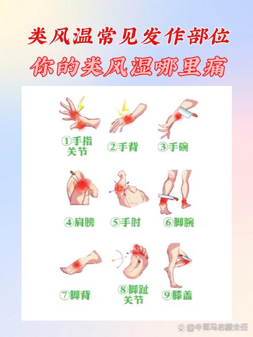 类风湿疼痛有哪些症状