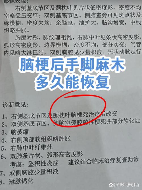 轻微脑梗多久恢复正常