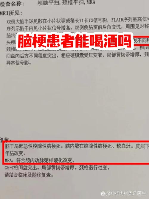 脑梗喝酒的危害有哪些