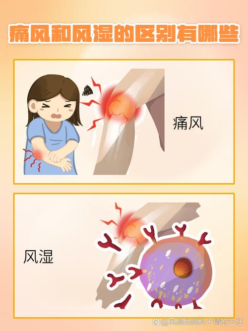 风湿是怎样形成的原因