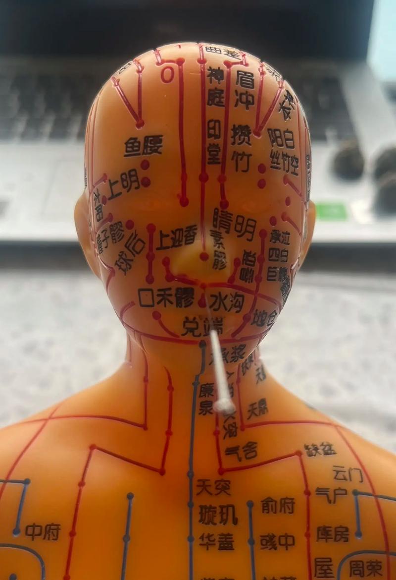 脑卒中针炙什么穴位