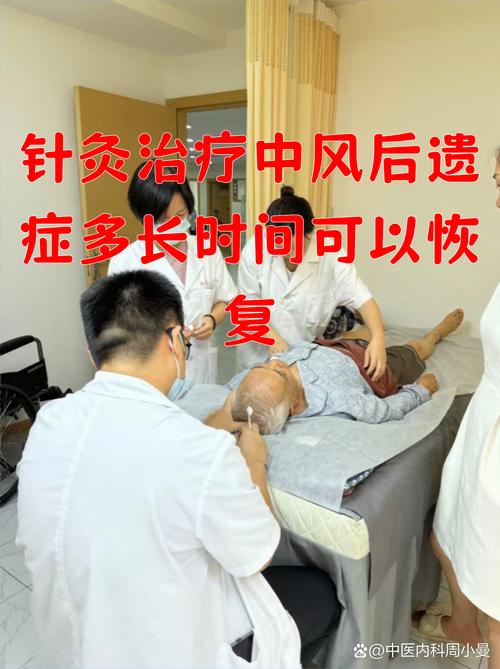 脑卒中针炙什么穴位