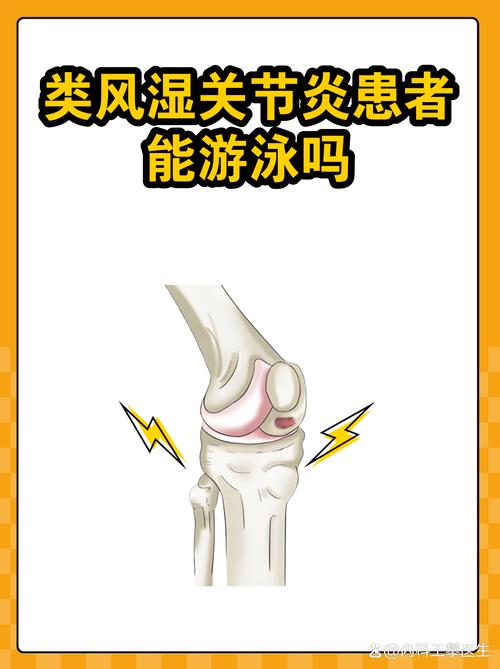 早期类风湿可以游泳吗