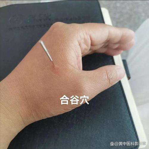 风湿手指关节疼痛艾灸