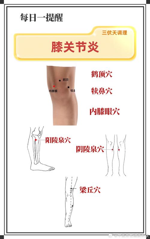 膝盖疼 穴位治疗